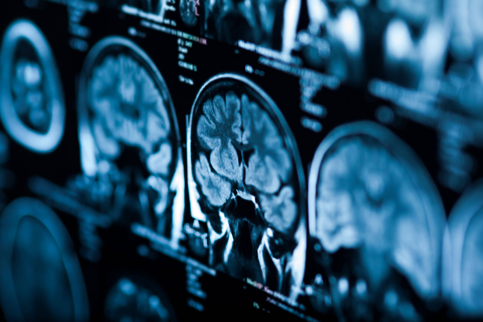 OpenSided MRI PACS Portal for Providers
